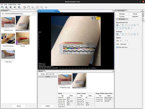 Download Weasis DICOM Viewer :: Weasis Documentation.